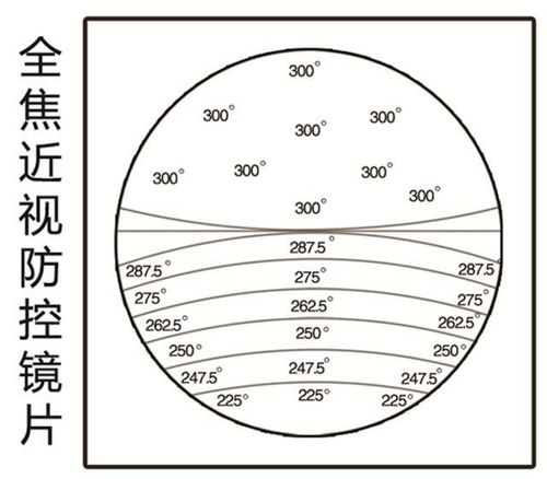 科技护眼新篇章 探秘摩尔视力佳全焦近视防控眼镜的光学防控原理